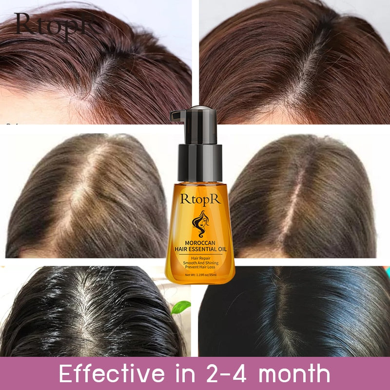 Moroccan Prevent Hair Loss Product Hair Growth Essential Oil Easy To Carry Hair Care Nursing 35ml Oil Suitable For All Skin - youronestopstore23