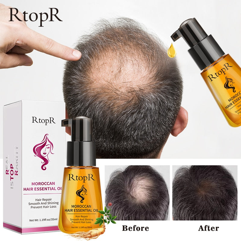Moroccan Prevent Hair Loss Product Hair Growth Essential Oil Easy To Carry Hair Care Nursing 35ml Oil Suitable For All Skin - youronestopstore23